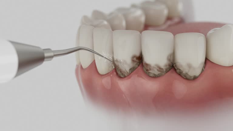 Reliable Dental contractor in Warsaw, MO by Dentist Open Now